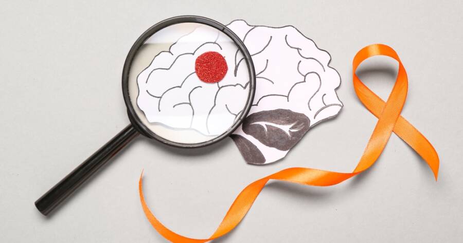 The Latest Treatments Helping People Manage Multiple Sclerosis